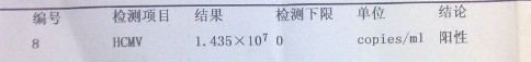 第一次细胞病毒检查
