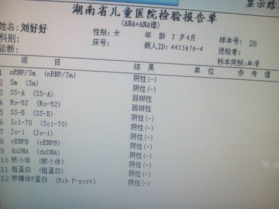 ANA检查结果
